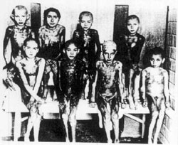 Auschwitz: Halbverhungerte Kinder mit furchtbaren Brandwunden nach medizinischen Versuchen