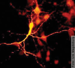 Nahaufnahme einer Nervenzelle - Wie lässt sich die Parkinson-Krankheit behandeln? (Parkinson-Forschung)